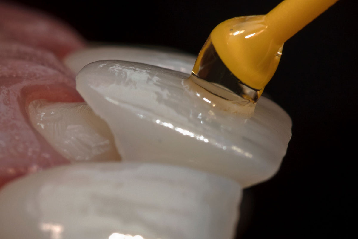 Why Composite Veneers Are a Healthier, Low-Impact Choice
