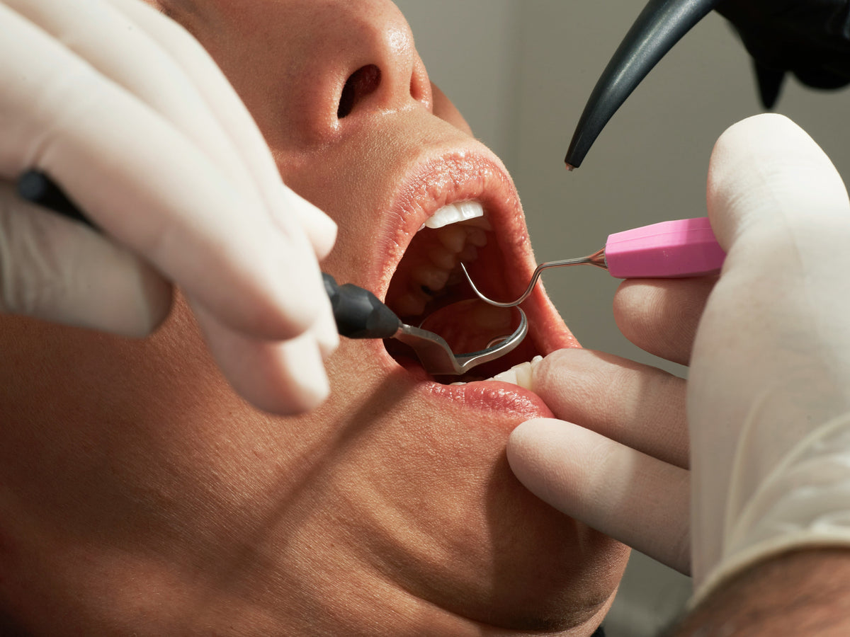 Long-Lasting, Eco-Friendly Dental Implants Explained